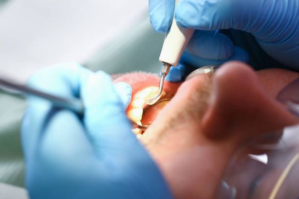 Best After-Hours Emergency Dentist in Merriam, KS