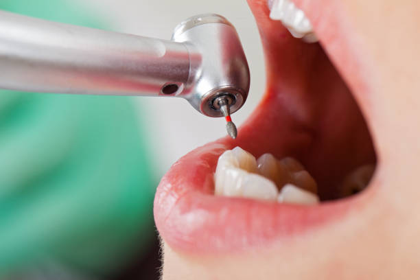 Best Weekend Emergency Dentist in Merriam, KS